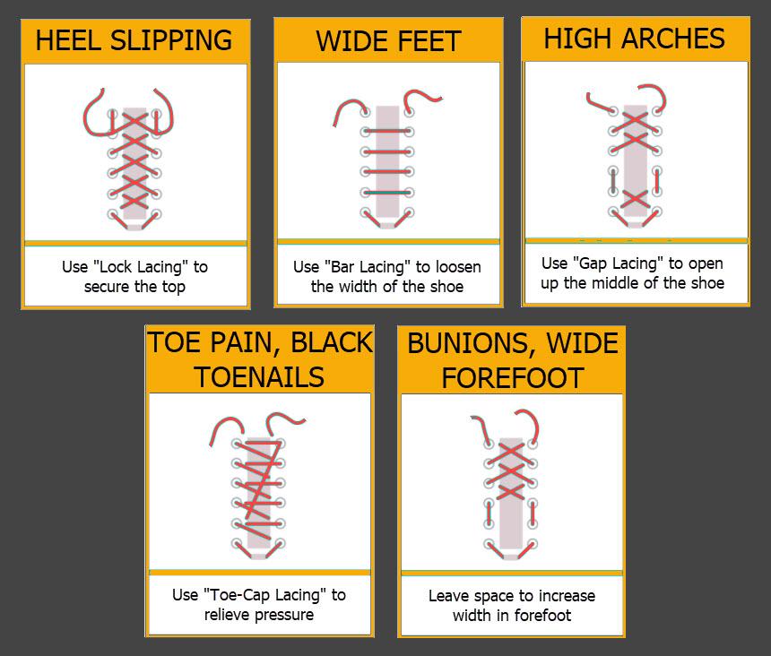 Shoe Lacing Techniques Can Alleviate Many Common Foot Problems